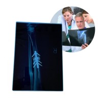 A4 Waterproof PET Xray Blue Medical Film Sheet for Digital Printing